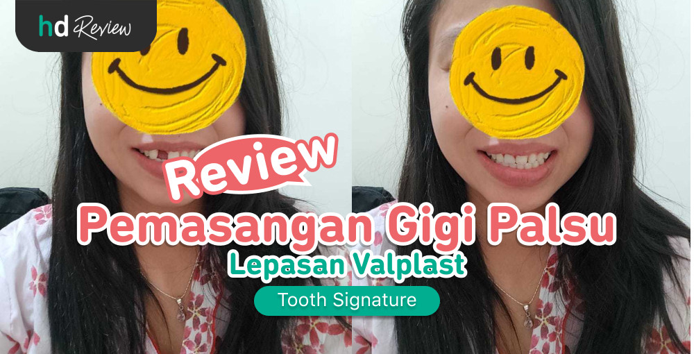 Review Pemasangan Gigi Palsu Lepasan Valplast Di Klinik Tooth Signature