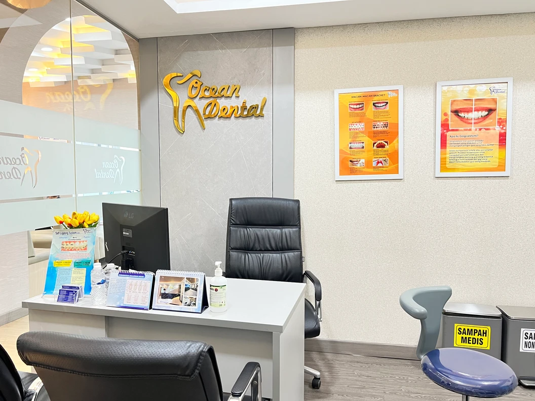 Bleaching Gigi at Office Signature di Ocean Dental