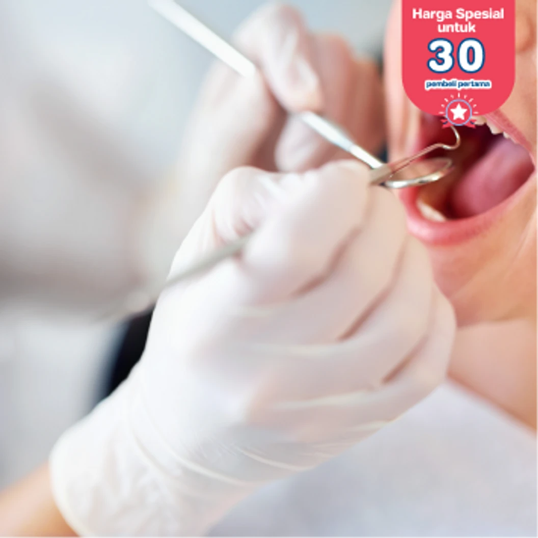 Scaling Gigi di Ocean Dental