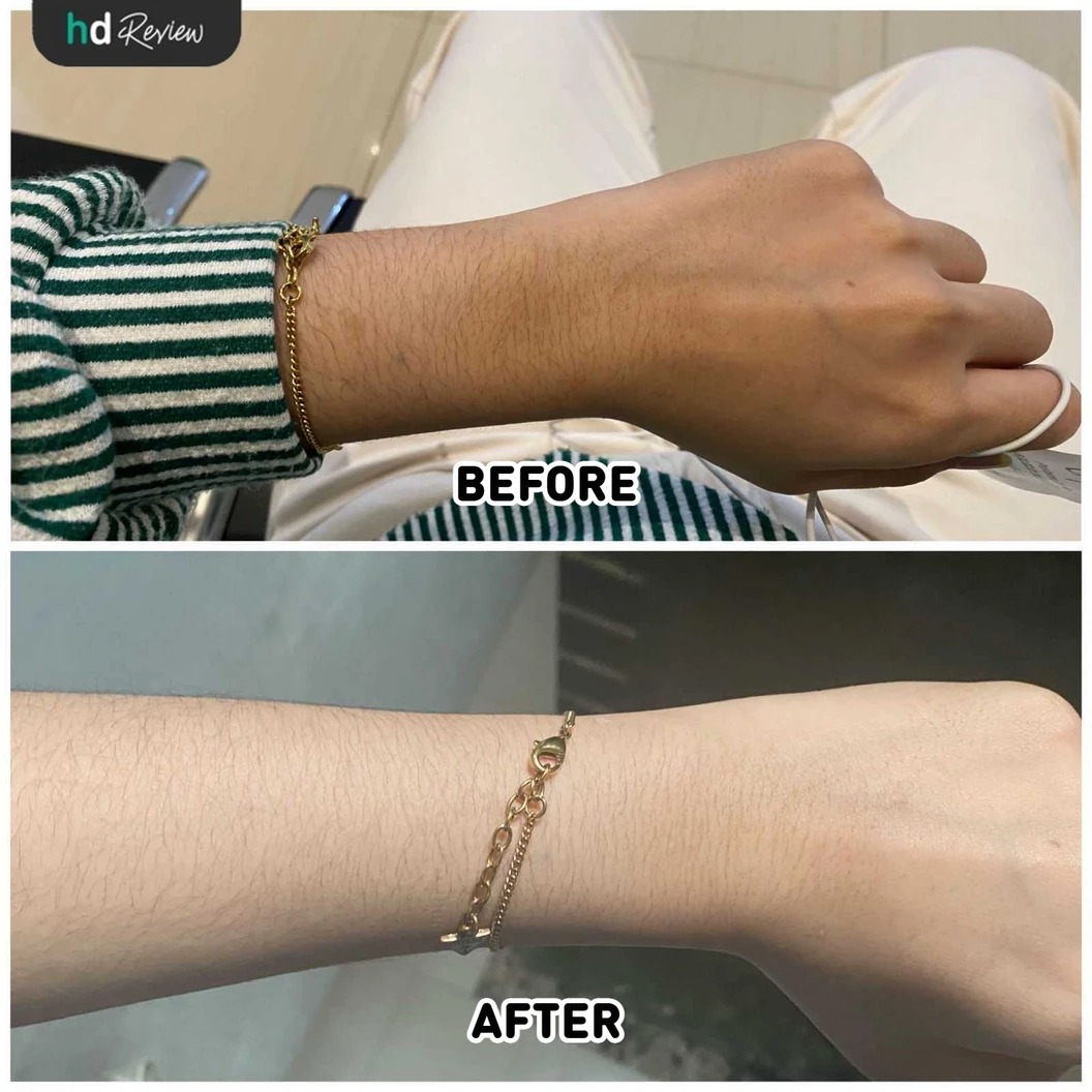 Vita Glow Infusion di Derma Express