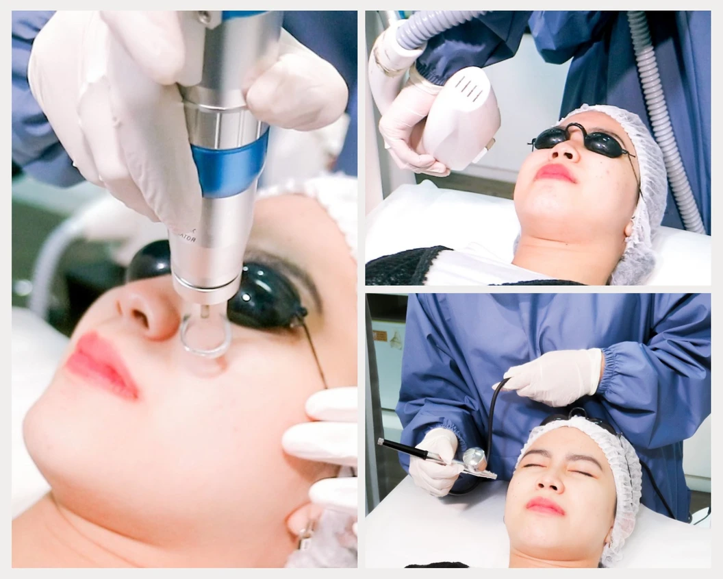 Photo Laser + Photo Shower + Rejuve Oxy Infusion (Paket New Customer) di Pure Laser Clinic