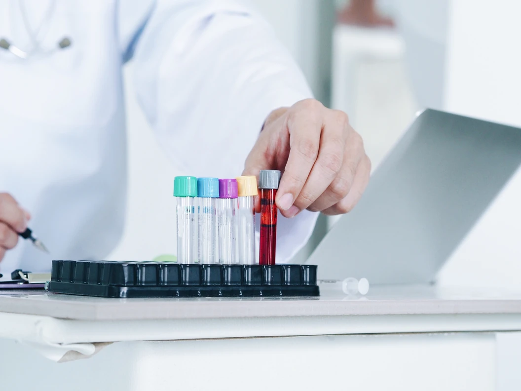 Pemeriksaan Beta-hCG (Kuantitatif) Pria di Innoquest