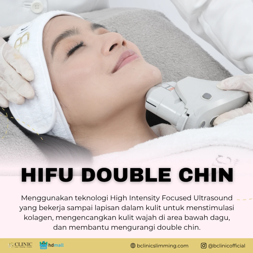 HIFU Double Chin di B Clinic Slimming & Aesthetic
