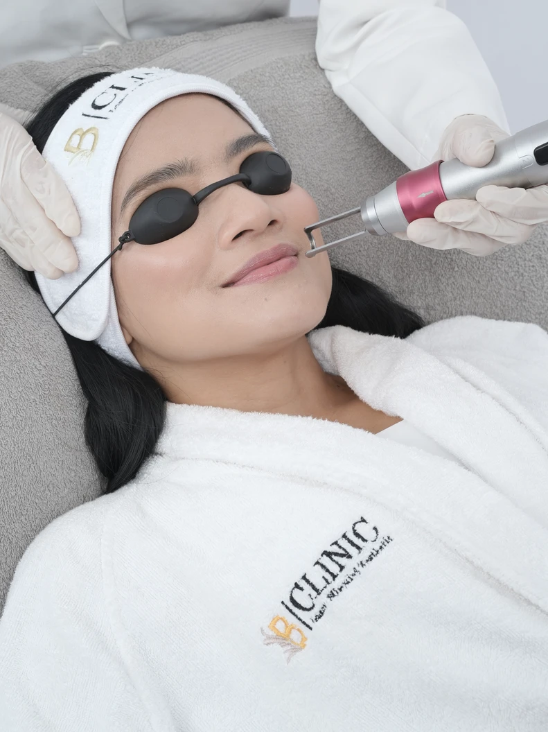 2 In 1 Pico Laser Lip Pink di B Clinic Slimming & Aesthetic