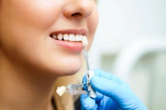 Crown di Tooth's Kingdom Dental