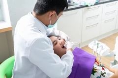 Implan Gigi di Host Dental Clinic