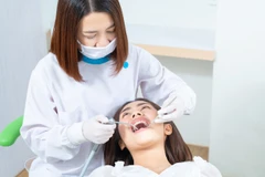 Scaling Gigi + Pemeriksaan Gigi dengan Kamera Intraoral + Polishing di Tooth's Kingdom Dental Care