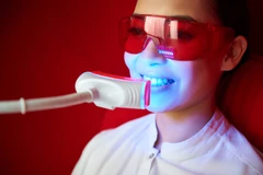 Bleaching Gigi dengan Sinar Zoom Phillip di My N Your Dentist