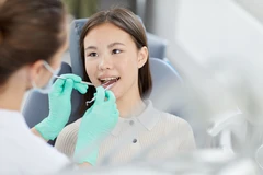 Tambal Gigi Fissure Sealant Komposit atau Glass ionomer di My N Your Dentist