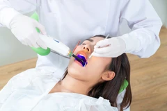 Perawatan Saluran Akar Paket PSA/RCT 2 saluran di Tidi Dental Clinic