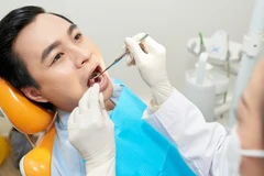 Direct Veneer Komposit Amaris 8 Gigi + Polishing di Klinik Gigi Dewi