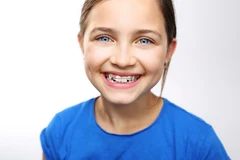 Retainer Lepasan Hawley per Rahang di Brillo Dental Care