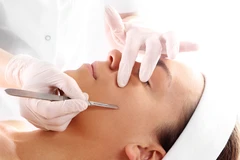Cauter per Titik di Klinik Estetik Ambrosia
