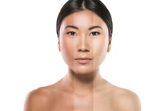 Infus Brightening Premium (Multivitamin dan Antioksidan) di Klinik Estetik Ambrosia