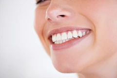 Scaling Gigi (Kasus Berat/Kelas III) di Cheerful Dental Clinic