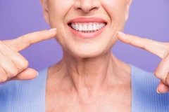 Implan Gigi Paket Super di Cheerful Dental Clinic