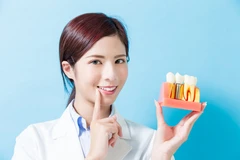 Implan Gigi Kasus Kompleks di Cheerful Dental Clinic
