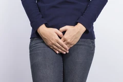 Pap Smear (LBC) di Klinik Kiara