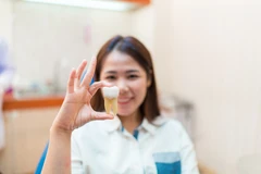 Perawatan saluran akar (per kunjungan) di Pearl Dental