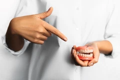 Gigi Palsu Lepasan Fleksibel (Plat + 1 Gigi) di Empire Dental Studio