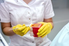 Paket perawatan saluran akar tunggal + Penambalan sinar di Fidental Clinic