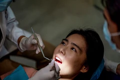 Scaling Gigi + Polishing di Fidental Clinic