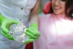 Bridge Porcelain Fused to Metal (PFM) di Mydentismile