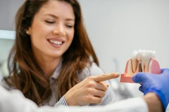 Implan Gigi Nobel Biocare atau Straumann Swiss di Embun Galaxi Dental Care