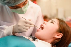 Tambal Gigi Komposit (Kasus Sedang) di Embun Galaxi Dental Care