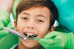 Cabut Gigi Susu + Injeksi Anestesi di Embun Galaxi Dental Care