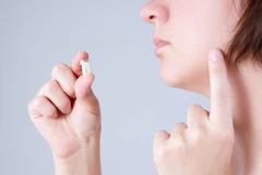 Cabut Gigi Bungsu (Odontektomi) di Embun Galaxi Dental Care