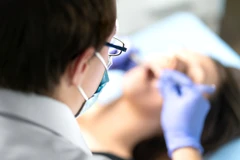 Cabut Gigi Bungsu (Odontektomi Molar Ketiga) oleh Drg. Spesialis Bedah Mulut di Schon Dental