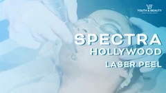 Spectra Hollywood Laser Peel + Free Aqua peel Facial di Youth & Beauty Clinic Aestetic & Skin