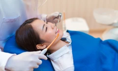 Indirect Veneer Porcelain di Klinik Tooth Signature