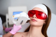 Paket Laser Skin Whitening (IPL + Laser Glowing + Oxy) 3x Brienna Clinic