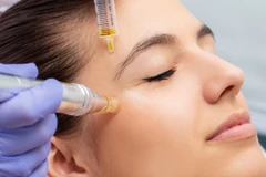 Injeksi Skin Booster Platinum di Brienna Clinic