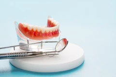 Konsultasi Dental 1x di Tidi Dental