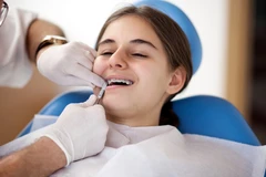 Pelepasan Behel di Tooths Kingdom Dental Care