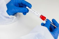 Home Service: Swab PCR 10-30 Orang Hasil 1 Hari di Klinik Djanti Medika