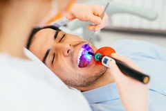 Tambal Gigi (Kavitas Sedang) di Fidental Clinic