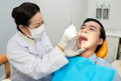 Tambal Gigi Resin Komposit di Tooth's Kingdom Dental Care