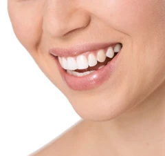 Tambal Gigi Depan di Brillo Dental Care