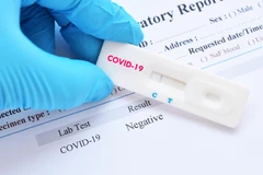 COVID-19 Rapid Antibody Test di Klinik Widya Bhakti Inti