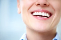 Bleaching Gigi dengan LED di PI Dental Care