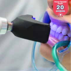 Bleaching Gigi dengan LED + Scaling Gigi di Klinik Gigi Dentalosophy