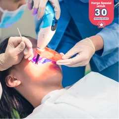 Tambal Gigi Belakang Bahan Resin Komposit di Dentistique Clinic