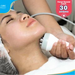 Double Chin Reduction dengan Radio Frequency (First Time Purchase) di Pure Laser Clinic