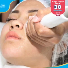 V-Shaped Face Contouring dengan Radio Frequency (First Time Purchase) di Pure Laser Clinic