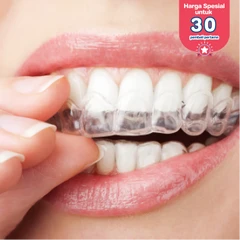 Retainer Lepasan Clear 1 Rahang + Cetak Gigi di DENTALMATE DENTALCARE