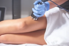 RF Arms or Legs Slimming di La Lune Beauty